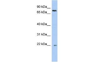 WB Suggested Anti-NHLRC2 Antibody Titration: 0.