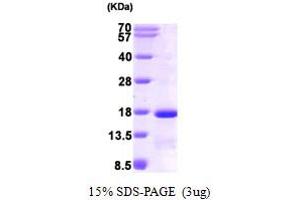 Eukaryotic Translation Initiation Factor 1 (EIF1) (AA 1-113) protein (His tag)