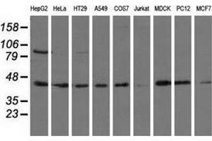 Western blot analysis of extracts (35 µg) from 9 different cell lines by using anti-ALDH1L1 monoclonal antibody. (ALDH1L1 Antikörper)