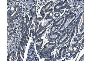 IHC analysis of Agrin/AGRN using anti-Agrin/AGRN antibody (ABIN7600387). (AGRN Antikörper  (AA 1864-2068))