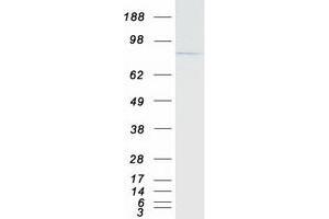 Western Blotting (WB) image for Bromodomain Containing 7 (BRD7) protein (Myc-DYKDDDDK Tag) (ABIN2715327)
