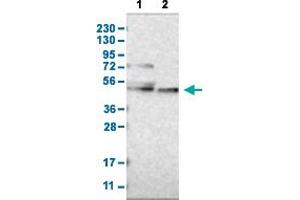 Western Blot analysis with CYP26B1 polyclonal antibody . (CYP26B1 Antikörper  (AA 201-310))