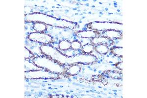 Immunohistochemistry of paraffin-embedded Mouse kidney using TBCCD1 Rabbit pAb (ABIN7270751) at dilution of 1:100 (40x lens). (TBCCD1 Antikörper)