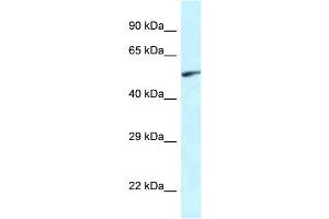 WB Suggested Anti-Eya2 Antibody Titration: 1. (EYA2 Antikörper  (Middle Region))