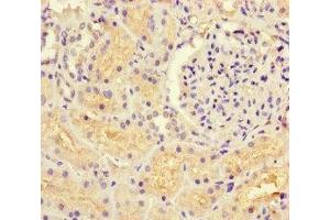 Immunohistochemistry of paraffin-embedded human kidney tissue using ABIN7154769 at dilution of 1:100 (GUCY1A1 Antikörper  (AA 20-152))