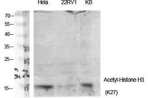 Western Blot (WB) analysis of specific cells using Acetyl-Histone H3 (K27) Polyclonal Antibody. (Histone 3 Antikörper  (H3K27ac))