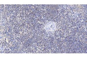 Detection of b2M in Human Spleen Tissue using Monoclonal Antibody to Beta-2-Microglobulin (b2M) (beta-2 Microglobulin Antikörper  (AA 22-119))