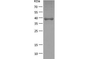 GPD1 Protein (AA 1-349) (His tag)