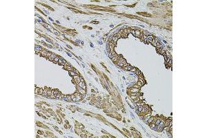 Immunohistochemistry of paraffin-embedded human prostate using FLNB antibody. (FLNB Antikörper)