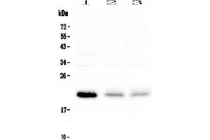 Western blot analysis of BNIP3 using anti-BNIP3 antibody . (BNIP3 Antikörper)