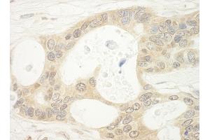 Immunohistochemistry (IHC) image for anti-Folliculin (FLCN) (AA 1-50) antibody (ABIN7448434) (FLCN Antikörper  (AA 1-50))