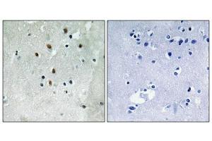 Immunohistochemistry analysis of paraffin-embedded human brain tissue using SRF (Phospho-Ser77) antibody. (SRF Antikörper  (pSer77))