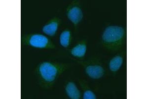 IF analysis of USP16 using anti-USP16 antibody (ABIN7599650). (USP16 Antikörper  (AA 103-683))