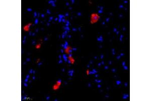 Immunofluorescence of paraffin embedded mouse lymph node using BIRC3 (ABIN7073179) at dilution of 1: 1000 (400x lens) (BIRC3 Antikörper)