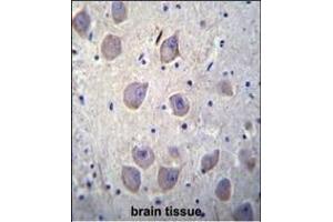 Immunohistochemistry (Paraffin-embedded Sections) (IHC (p)) image for anti-Arrestin, beta 1 (ARRB1) (AA 336-363), (C-Term) antibody (ABIN655944)
