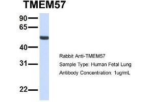 Host:  Rabbit  Target Name:  TMEM57  Sample Type:  Human Fetal Lung  Antibody Dilution:  1. (TMEM57 Antikörper  (N-Term))
