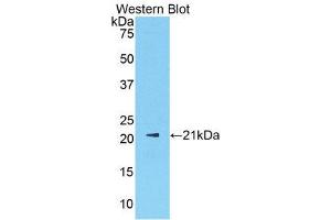 Western Blotting (WB) image for anti-Sex Hormone Binding Globulin (SHBG) (AA 219-358) antibody (ABIN1172838) (SHBG Antikörper  (AA 219-358))