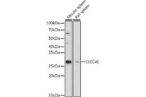 Western blot analysis of extracts of various cell lines, using CLEC4E antibody (ABIN7265982) at 1:1000 dilution. (CLEC4E Antikörper)