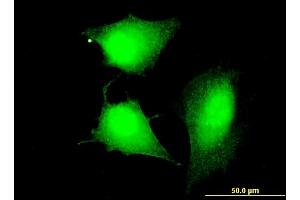 Immunofluorescence (IF) image for anti-Coiled-Coil Domain Containing 83 (CCDC83) (AA 341-444) antibody (ABIN531342)
