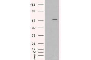 Image no. 2 for anti-Myotubularin 1 (MTM1) (C-Term) antibody (ABIN374119) (MTM1 Antikörper  (C-Term))