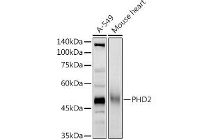 Western blot analysis of extracts of various cell lines, using PHD2 antibody (ABIN7266909) at 1:1000 dilution. (EGLN1 Antikörper  (AA 1-426))