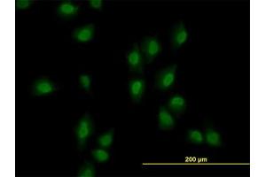 Image no. 2 for anti-AT Rich Interactive Domain 1B (SWI1-Like) (ARID1B) (AA 1364-1461) antibody (ABIN599288) (ARID1B Antikörper  (AA 1364-1461))