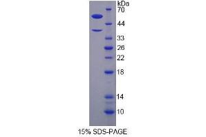 SDS-PAGE analysis of Human H2AFY Protein. (H2AFY Protein)