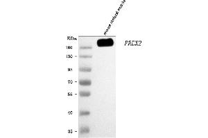 anti-DEP Domain Containing 2 (DEPDC2) (AA 582-1094) antibody