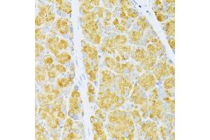 Immunohistochemistry of paraffin-embedded rat pancreas using FLT3 antibody (ABIN6134576, ABIN6140691, ABIN6140694 and ABIN6216061) at dilution of 1:100 (40x lens). (FLT3 Antikörper  (AA 650-750))