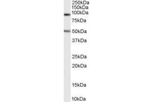 Western Blotting (WB) image for anti-Chromosome 16 Open Reading Frame 90 (C16ORF90) (N-Term) antibody (ABIN2791458) (C16ORF90 Antikörper  (N-Term))