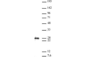 MGMT antibody (pAb) tested by Western blot. (MGMT Antikörper  (C-Term))