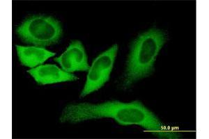 Immunofluorescence of monoclonal antibody to FASN on HeLa cell. (Fatty Acid Synthase Antikörper  (AA 1-439))