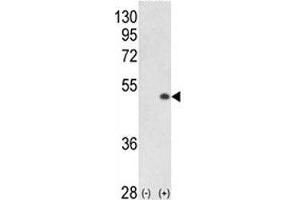 Western blot analysis of PCTAIRE1 antibody and 293 cell lysate (2 ug/lane) either nontransfected (Lane 1) or transiently transfected with the PCTK1 gene (2). (CDK16 Antikörper  (AA 357-386))