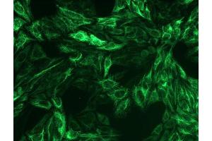Immunocytochemistry staining of cytokeratin 8 in Hep-2 cells using mouse monoclonal antibody C-51 ((ABIN94298), diluted 1:200), detected with GAM IgG-Alexa Fluor488 (diluted 1:100, green). (KRT8 Antikörper)