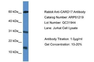 Western Blotting (WB) image for anti-Caspase Recruitment Domain Family, Member 17 (CARD17) (Middle Region) antibody (ABIN2788724)