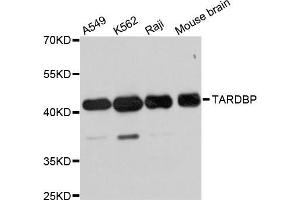 Western blot analysis of extracts of various cell lines, using TARDBP antibody (ABIN5999467) at 1/1000 dilution. (TARDBP Antikörper)