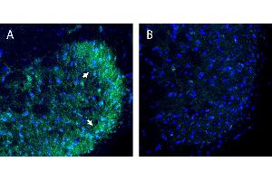 Free-floating frozen spinal cord sections from a paraformaldehyde-perfused rat were incubated with Anti-B1 Bradykinin Receptor (BDKRB1) (extracellular) Antibody (ABIN7581830, 1:300), followed by goat anti-rabbit secondary antibody conjugated to Alexa Fluor® 488 (green). (BDKRB1 Antikörper  (Extracellular, Loop 2))