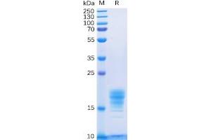 Human IL5 Protein, His Tag on SDS-PAGE under reducing condition.
