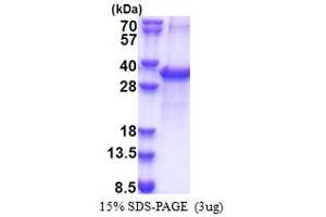 ACOT11 Protein (AA 19-250) (His tag)