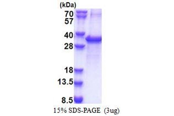 ACOT11 Protein (AA 19-250) (His tag)