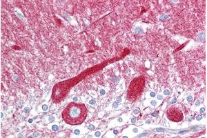 Immunohistochemistry with Brain, cerebellum tissue at an antibody concentration of 5µg/ml using anti-CPE antibody (ARP58445_P050) (CPE Antikörper  (N-Term))