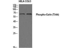 Western Blot (WB) analysis of HeLa COLO205 using Phospho-Ezrin (T566) antibody. (Ezrin Antikörper  (pThr566))
