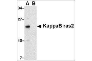 Western blot analysis of KappaB ras2 in RAW264. (NKIRAS2 Antikörper  (C-Term))