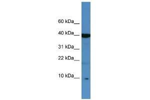 WB Suggested Anti-SPINK6 Antibody Titration: 0.