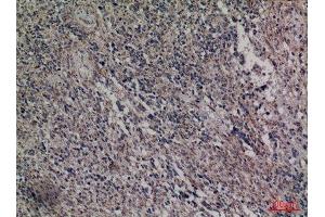 Immunohistochemistry (IHC) analysis of paraffin-embedded Human Brain, antibody was diluted at 1:100. (HDC Antikörper  (Internal Region))