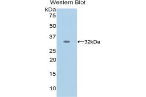 Detection of Recombinant NES, Human using Monoclonal Antibody to Nestin (NES) (Nestin Antikörper  (AA 178-399))