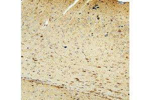 IHC analysis of FACL4/ACSL4 using anti-FACL4/ACSL4 antibody (ABIN7602756). (ACSL4 Antikörper  (C-Term))