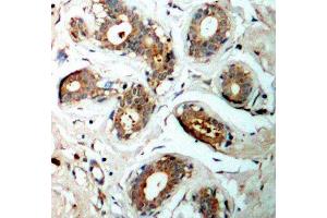 Immunohistochemistry (IHC) image for anti-14-3-3 zeta (YWHAZ) (pSer58) antibody (ABIN3019773) (14-3-3 zeta Antikörper  (pSer58))