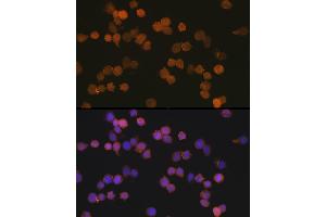 Immunofluorescence analysis of THP-1 cells using //IB Rabbit mAb (9776) at dilution of 1:100 (40x lens). (Iba1 Antikörper)