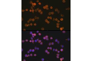 Immunofluorescence analysis of THP-1 cells using //IB Rabbit mAb (9776) at dilution of 1:100 (40x lens). (Iba1 Antikörper)